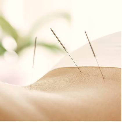 Aiguilles d'acupuncture